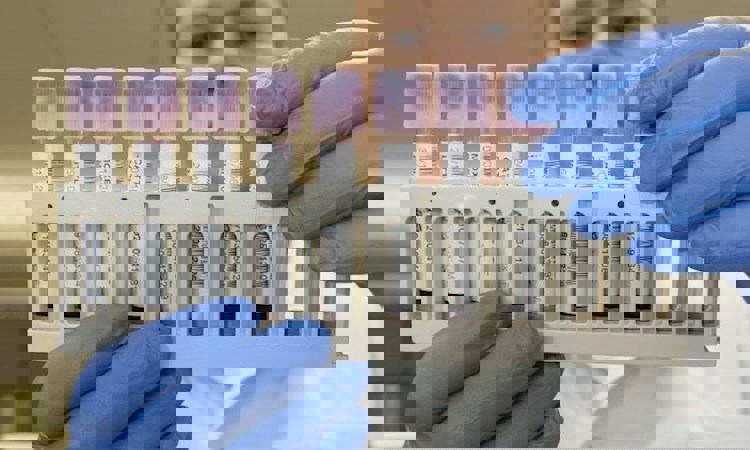 Research and Development